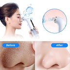 *Super Micro Bubble Beauty Instrument Black Head Remover*